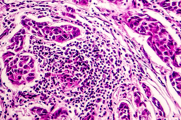 Le système lymphatique