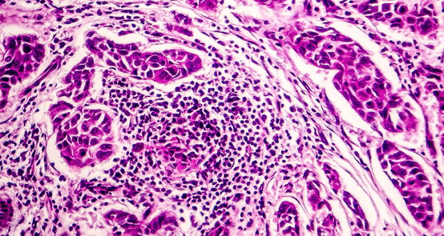 Le système lymphatique